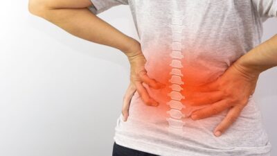 Bel Kayması (Spondilolistezis) Günlük Hayatı Zorlaştırabiliyor Bel kayması, omurga sağlığını